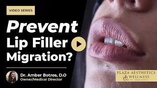 How Can I Prevent Lip Filler Migration? | Plaza Aesthetics & Wellness