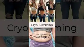 Cryo Slimming & Cryo Toning 1 Missoula Montana