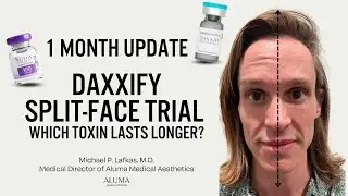 Daxxify vs Botox Split Face Trial | 1 Month Update | How Long Will Daxxify Last? (Part 3)