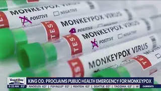 King Co. proclaims public health emergency for monkeypox | FOX 13 Seattle