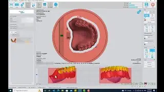 Nesting CUD-CLD for Milling on Ivoclar's PM7