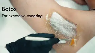 excessive sweating ( Hyperhidrosis ) explained