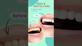 Solution of Tooth Discoloration