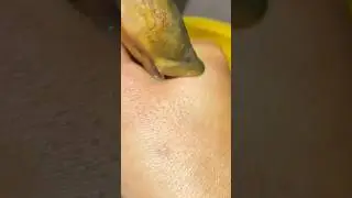 Detik-detik tangan digigit belut!! 😅😅 #shorts