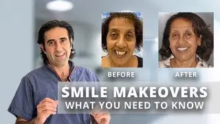 Smile Makeovers with veneers and crowns in Washington DC.