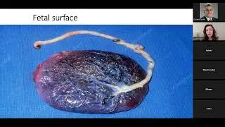 Placental Pathology: Interpretation and Structured Reporting in Contemporary Practice