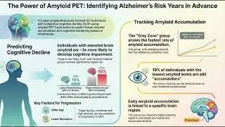 Quantifying the Earliest Signals of Alzheimer&rsquo;s Disease: Baseline Amyloid PET as a Predictor-Podcast