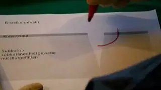 Theorie Einzelknopfnaht