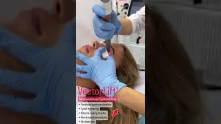 Non-Invasive Eyebrow Lift and Eye-Lid Tightening with Vectorlift at EDEN AESTHETICS