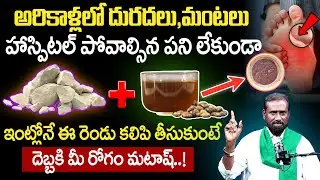 అరికాళ్లలో మంటలు పోవాలంటే | How To Cure Itching And Burning Feet | Shaik Nabi Rasol | Its UTV Health