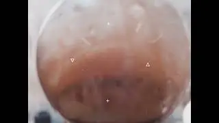 Spagyric anatomy