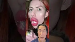 Can&rsquo;t Stop Watching Those Lips! #shorts #asmr #lipinjections