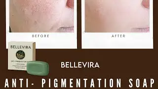 Anti- Pigmentation Soap | Chemical Free | Bellevira Naturals 