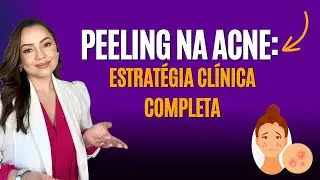 Peeling para Acne: Protocolo Completo e Seguro | Aula Gratuita