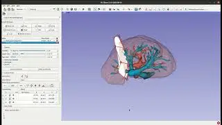 Slicer-liver tutorial