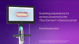 How to scan veneers with the iTero Element&trade; Plus scanner | step-by-step execution