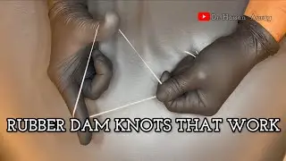 Rubber Dam Floss Trick Explained | Single Knot & Double Self-Ligating Knot Step by Step