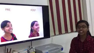 Testimonial video | Siri Dental Hospital | Dr N Srinivas