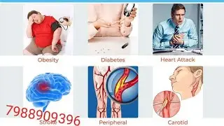 Testimony of Ipulse in Blood Pressure, Celastrol, muscles pain,body pain 🩺