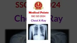 SSC GD 2024 Unfit Points 😭 #sscgd #crpf #cisf #viral #shorts #shortvideo #medical #ssc
