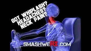 Neck Pain Whiplash and Headaches | Trevor Bachmeyer | SmashweRx