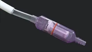 Articular Cartilage Repair Using Autologous Tissue Collected With the GraftNet™ Device