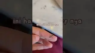 Nail Peel off (Comment)