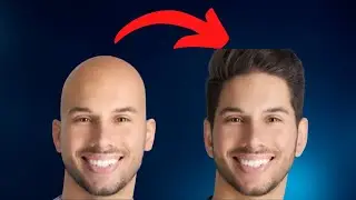 Male pattern baldness cure - How to treat hair loss for men (4 steps)