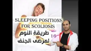 طريقة النوم للمرضى الجنف الحلقة 16