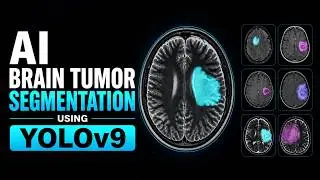 Brain Tumor Segmentation using YOLOv9 | Deep Learning Medical AI