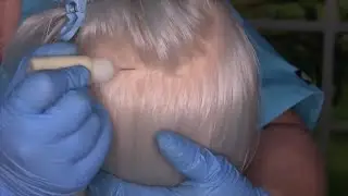 ASMR Dry Scalp Check and Treatment (Scalp Massage, Tweezers, Whispering) Medical Roleplay