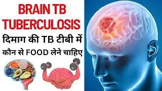Brain Tb Tuberculosis Food | दिमाग की TB टीबी में कौन से FOOD लेने चाहिए | Best food for Brain TB