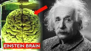 How Einstein's Brain was different ?