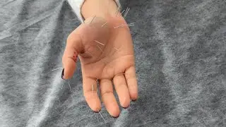Су Джок иглоукалывание 🖐️✨