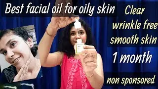 Best facial oil for oily acne prone skin | 1 month honest experience | ft. Plum hemp oil