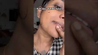 Day 4 of ABC Juice 🥤 subscriber and wait for live result#viralvideo #trending #skincare