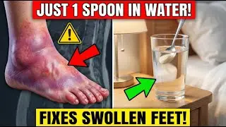 7 Bedtime Fixes That Drain Foot Swelling Overnight | Senior Health Tips