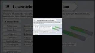 Lowenstein Jensen  (LJ) Medium I Purpose and Composition I Selective Media I Bacterial Culture Media