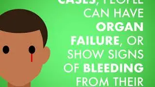 What is Lassa Fever ? MSF Video Animation
