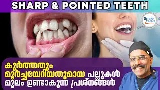 കൂർത്തതും മൂർച്ചയേറിയതുമായ പല്ലുകൾ മൂലം ഉണ്ടാകുന്ന പ്രശ്നങ്ങൾ Sharp Pointed Teeth Dr.Prasanth Pillai