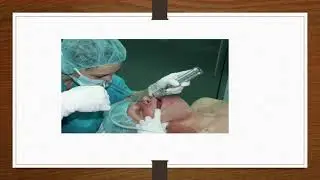 Conduct of general anesthesia | anesthesia | 6th grade | Dr. Amr Thabet