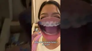 Dentist Reveals Why Broken Brackets Might NOT Be Your Fault! 😁🦷
