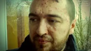 ВЗРОСЛАЯ ВЕТРЯНКА