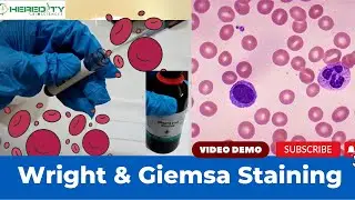 Wright & Giemsa Stain Experimental Procedure (Experimental Video)