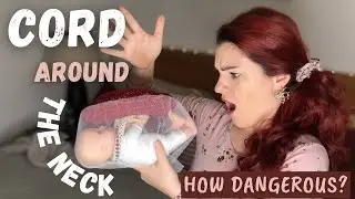 Cord Around Baby's Neck - Is It Dangerous?