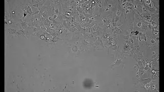 Fish Scale Keratocytes -- Tissue and Cell Motility