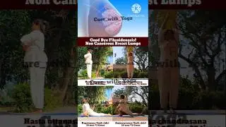 Transform Your Breast Health: Yoga to Ease Fibroadenosis (Non Cancerous Tumors) and Feel Empowered