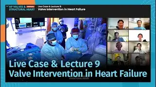 [AP VALVES & SH 2021] Live Case & Lecture 9: Valve Intervention in Heart Failure