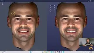 Jak zaprojektować uśmiech w oprogramowaniu RAYFace z wykorzystaniem 3D Smile Design?