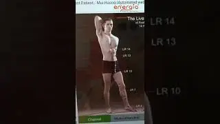 AcuGraph Energy Analysis: Unlock Your Health At Cellular Level!